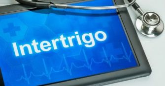 Intertrigo: Alles über das nässende Ekzem | apomio Gesundheitsblog