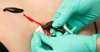 Blutegeltherapie – große Wirkung durch kleine Tierchen | apomio Gesundheitsblog