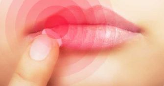 Lippen-Herpes: Die ganze Wahrheit über Lippen-Herpes | apomio Gesundheitsblog