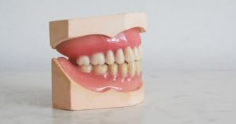 Platz schaffen für gesunde Zähne: die Gaumennahterweiterung macht es möglich | apomio Gesundheitsblog