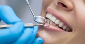 Professionelle Zahnreinigung für gesunde Zähne
