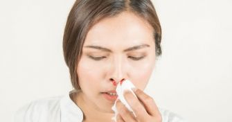 Was hilft bei Nasenbluten?