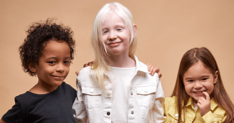 Symptome Ursachen Therapie Von Albinismus