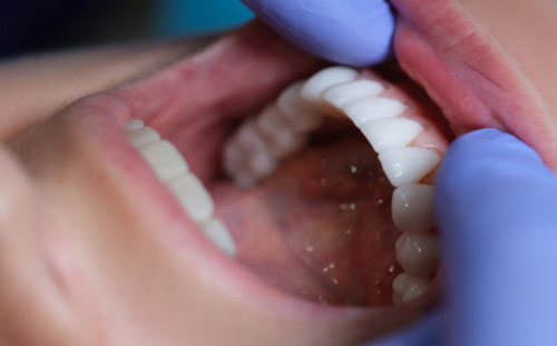 Die Mundhöhle ist der erste Teil des Verdauungstrakts - Apomio.de Gesundheitsblog